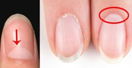 1 15 780x470 2 768x463