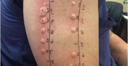 597887556 122242584878106243