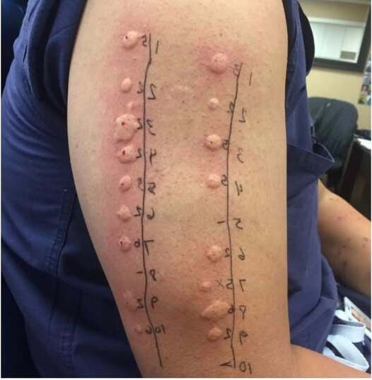 597887556 122242584878106243