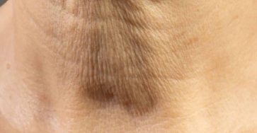 606011472 122106597171159225 8408785226414401701 n