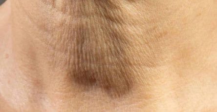 606011472 122106597171159225 8408785226414401701 n