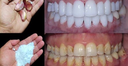 613582314 122100605727202893 413821963930319859 n