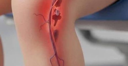 614907464 1573092624004910 8558789467952439433 n