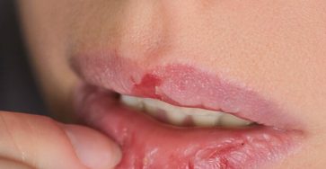 651015428 1477120460664088 2769530599022102049 n