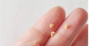 WhatsApp Image 2026 03 04 at 02.17.23