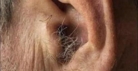 Le saviez vous si des poils commencent a pousser dans vos oreilles.jpg