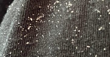 What are these white granules on my clothes and how do i v0 rd44kpnh4axc1 scaled
